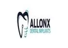 all On X Dental Implants