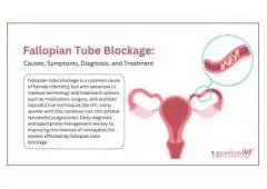 Fallopian Tube Blockage – Causes, Symptoms, Diagnosis, and Treatment
