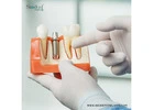 Explore the Best Dental Implants Brands in Guatemala Today