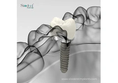 Top Trusted Dental Implant Manufacturers in Paraguay | 2025