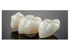Find minimally invasive Veneers in Tijuana with ultra-thin custom-made shells