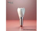 Dental Implant Products Wholesale in Paraguay Uncovered