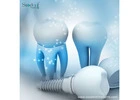 Recognized The Best Dental Implants Brands in Peru