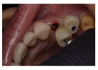 Holistic Dentist in Mexico – Natural, Biocompatible Care for Your Health and Smile