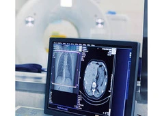 Enhance Diagnostic Accuracy with a Brand new X-ray machine