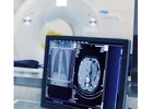 Enhance Diagnostic Accuracy with a Brand new X-ray machine