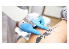 Best Tattoo Cream