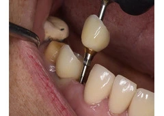 Trusted Dental Clinic in Tijuana – Comprehensive Care for a Brighter, Healthier Smile