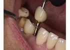 Trusted Dental Clinic in Tijuana – Comprehensive Care for a Brighter, Healthier Smile