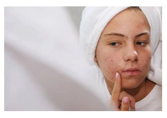 Effective Acne Treatment in Kolkata – Clear Skin, Renewed Confidence!