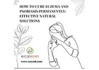 TSW Eczema Treatment: Natural Ways to Soothe and Heal Your Skin