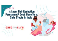Laser Hair Reduction in India: Cost, Benefits & Side Effects | EaseMyCure