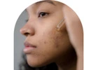 Cosmetic Dermatology Los Angeles – Dr Chinonso will Rejuvenate Your Skin