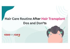 Hair Care Routine after Hair Transplant: Do's and Don'ts | EaseMyCure
