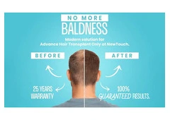Restore Your Hair and Confidence with New Touch Hair Transplant Clinic Ahmedabad