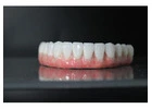 Dental implants Tijuana offers natural-looking and durable teeth replacements