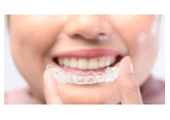 Affordable Braces Singapore – Straighten Your Smile with Expert Care