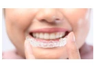 Affordable Braces Singapore – Straighten Your Smile with Expert Care