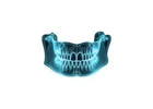 Professional Dental Marketing Company