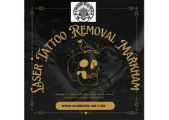 Laser Tattoo Removal Markham – Safe, Effective, and Precise Tattoo Removal