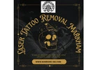 Laser Tattoo Removal Markham – Safe, Effective, and Precise Tattoo Removal