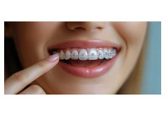 Bright Smiles Ahead: Professional Teeth Straightening for Kids