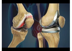 Advanced Orthopedic Treatment in Indore – By Dr. Sanjay Rawat