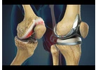 Advanced Orthopedic Treatment in Indore – By Dr. Sanjay Rawat