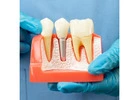 Dental Implant Solutions in Chembur, Mumbai