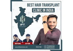 Best hair transplant clinic in India