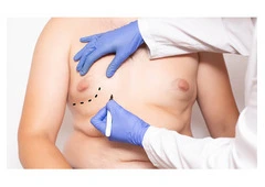 Cosmetic Surgery for Men: What’s Trending Right Now