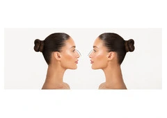 Rhinoplasty Surgery 101: What You Need to Know About Nose Reshaping