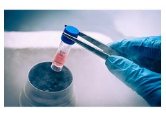 Fertility Preservation in Delhi - Dr Rhythm Gupta