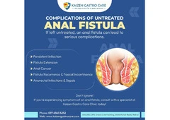 Anorectal Fistula Surgery in Pune | Kaizen Fistula Care