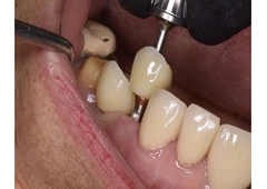 Trusted Dental Clinic in Tijuana – Comprehensive Care for a Brighter, Healthier Smile