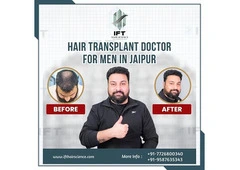 hair transplant doctor for men in Jaipur