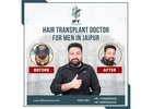 hair transplant doctor for men in Jaipur