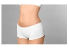 What is the Best Age for Liposuction Surgery?
