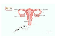 Best Fertility Treatment to Get Pregnant – Quick Guide