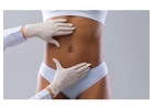 Excess Skin Removal Surgery in Delhi: What You Need to Know