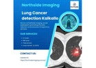 Lung Cancer Kalkallo
