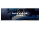 Dental implants Tijuana offers natural-looking and durable teeth replacements 
