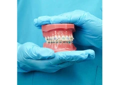 Straighten Your Teeth with Braces Treatment in Mumbai