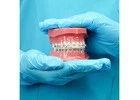 Straighten Your Teeth with Braces Treatment in Chembur