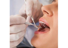 Affordable General Dentist for Routine Dental Checkups in Ronkonkoma