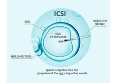 ICSI Treatment in Delhi - Dr Rhythm Gupta