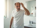 Regain Your Confidence with Expert Hair Restoration for Men in Los Angeles
