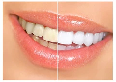Enhancing Smiles with Modern Cosmetic Dental Care