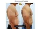 Gynecomastia Before and After: What Results Really Look Like