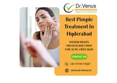 Best Pimple Treatment Near Me | Dr. Venus